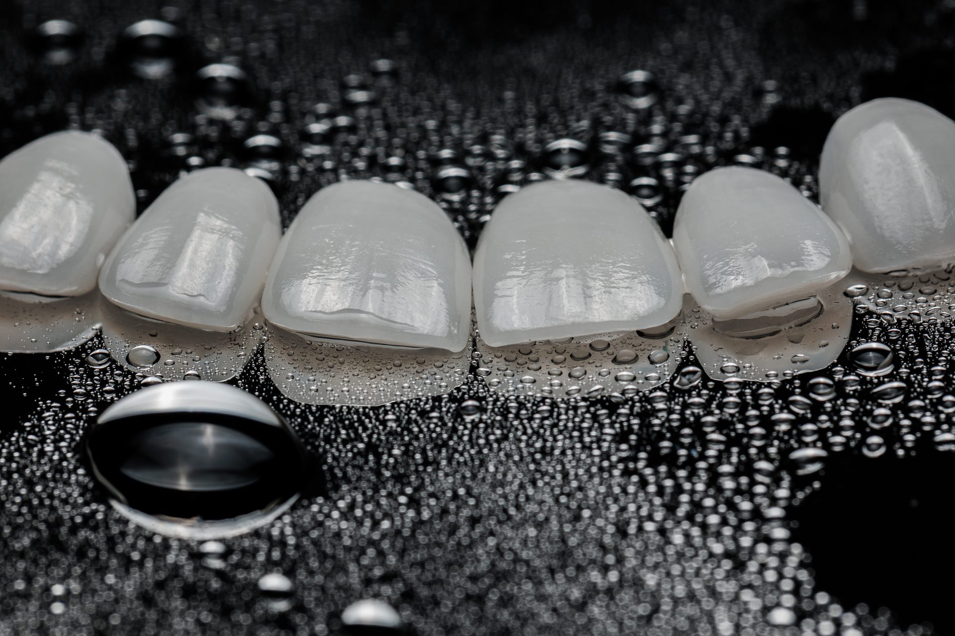 Dental crowns — when a filling is not enough
